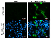 CXCR2 antibody [GT547]
