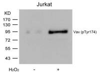 VAV1 (phospho Tyr174) antibody