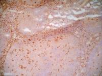 LRP1 antibody [A2Mr alpha-2]