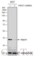 PSAT1 antibody [GT2918]