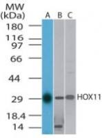 TLX1 antibody