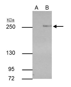 TET2 antibody [GT442]