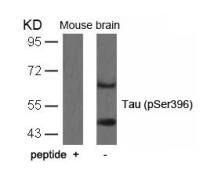 Tau (phospho Ser396) antibody