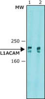 L1CAM antibody [UJ127.11]