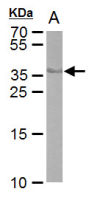 Cre recombinase antibody [GT10212]