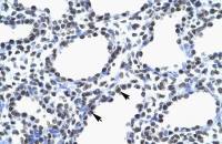 MYEF2 antibody, Internal