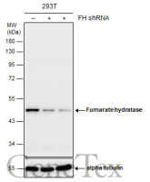 Fumarate hydratase antibody [GT548]