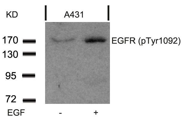 EGFR (phospho Tyr1068) antibody