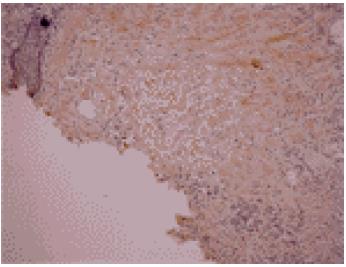 Osteocalcin antibody [OC4-30]