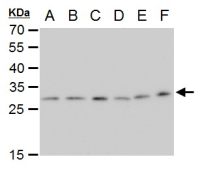 ETHE1 antibody [GT1621]