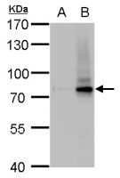 SLU7 antibody [GT262]