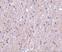 CTRP4 antibody