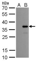 COL11A2 antibody [GT6410]