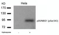 NBS1 (phospho Ser343) antibody