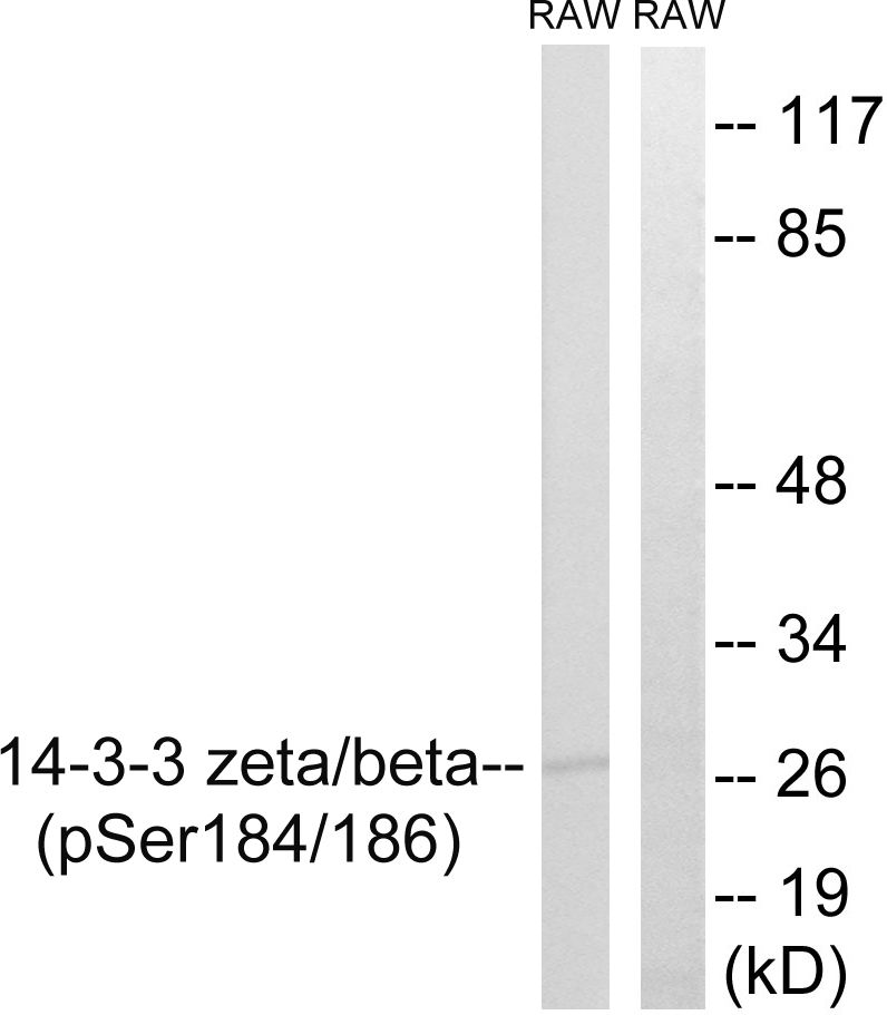 14-3-3 beta/zeta (phospho Ser186/Ser184) antibody