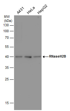 RNaseH2B antibody [GT479]