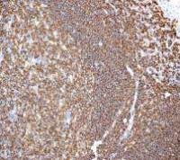 RIAM antibody [EPR2806]