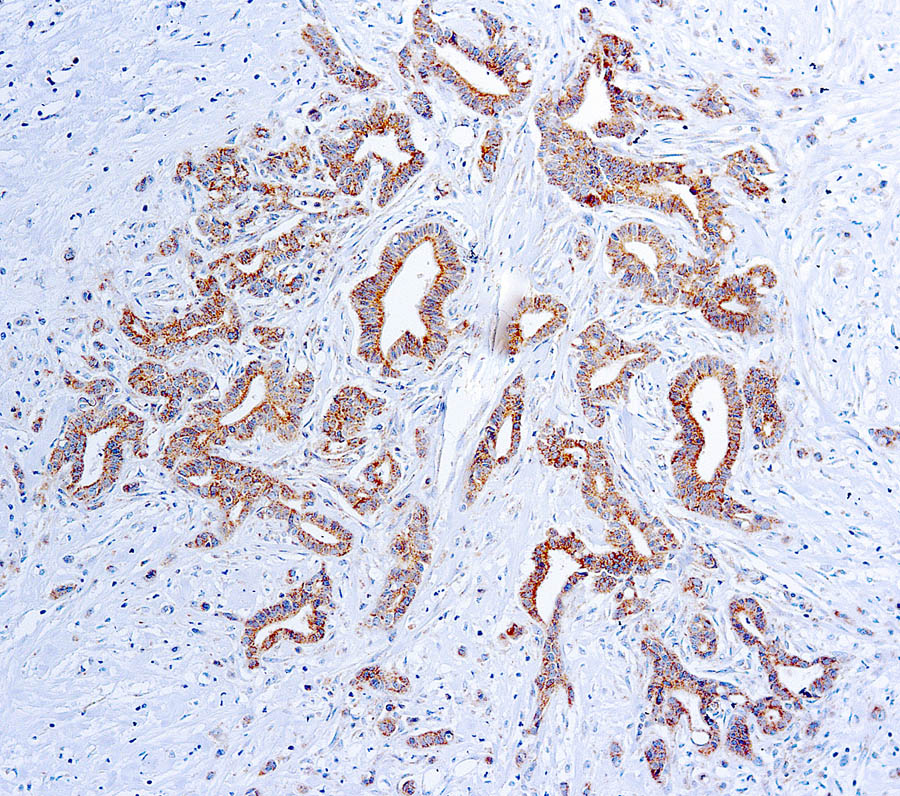 VEGFA antibody [VG1]