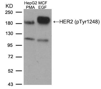 Her2 / ErbB2 (phospho Tyr1248) antibody