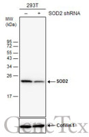 SOD2 antibody [GT582]