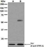 Src (phospho Tyr416) antibody [EPR6239(2)]