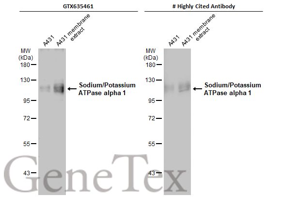 Sodium/Potassium ATPase alpha 1 antibody [HL114]