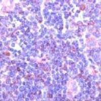 Syk antibody [SPM147]