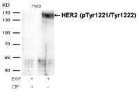 Her2 / ErbB2 (phospho Tyr1221/Tyr1222) antibody