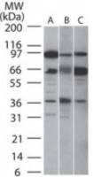 SIRT5 antibody