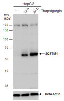 SQSTM1 / P62 antibody [GT239]
