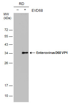 Enterovirus D68 VP1 antibody [GT11610]