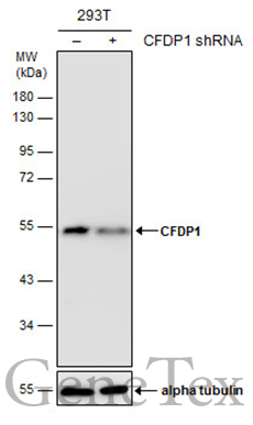 CFDP1 antibody [GT9612]