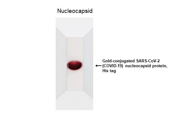 SARS-CoV-2 (COVID-19) Nucleocapsid protein, His tag (Gold)