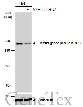 MYH9 (phospho Ser1943) antibody [GT144]