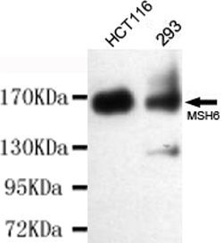 MSH6 antibody [3E1-B11-F12]