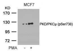 PKC mu (phospho Ser738) antibody