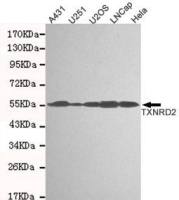 TXNRD2 antibody [3F2-E12-F10]