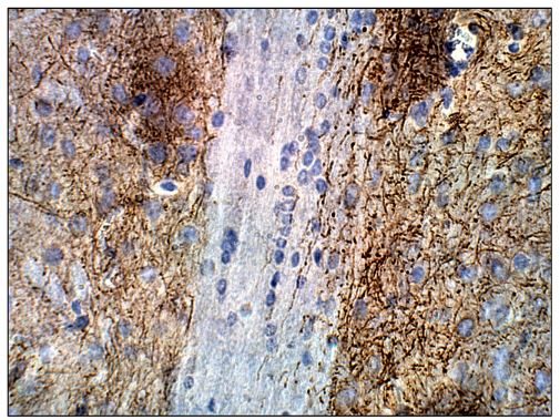 Adenylate cyclase 2 antibody