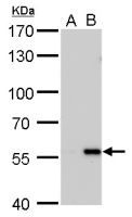 Carbonic Anhydrase IX antibody [GT546]