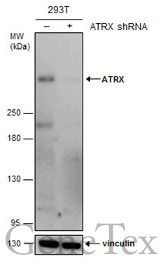 ATRX antibody [GT4212]