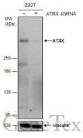 ATRX antibody [GT4212]