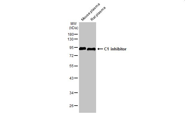C1 inhibitor antibody [HL1197]