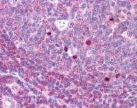 Aurora B (phospho Thr232) antibody