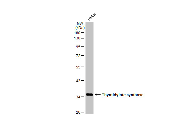 Thymidylate synthase antibody [HL1236]
