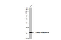 Thymidylate synthase antibody [HL1236]