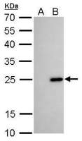 Bcl-2 antibody [GT11210]