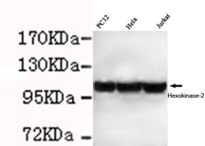 Hexokinase II antibody [1E8-H3-F11]