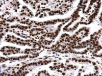 Histone H4K8ac (acetyl Lys8) antibody [GT478]