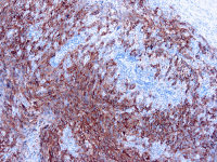 Melanoma antibody [HMB45+A103+T311]