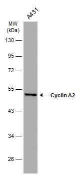 Cyclin A2 antibody [GT2547]